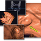 Image for article titled What's the Future of Cancer Diagnosis?